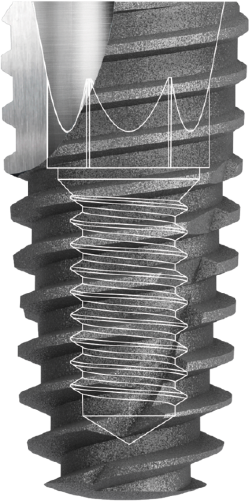 PRIMUS implant features