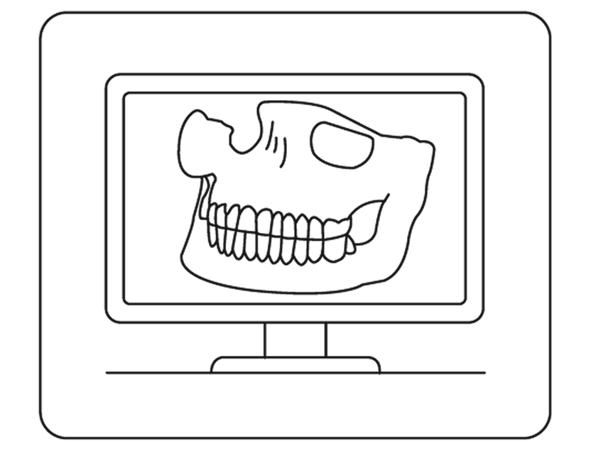 CBCT Review and Case Planning