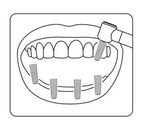 Surgical Planning