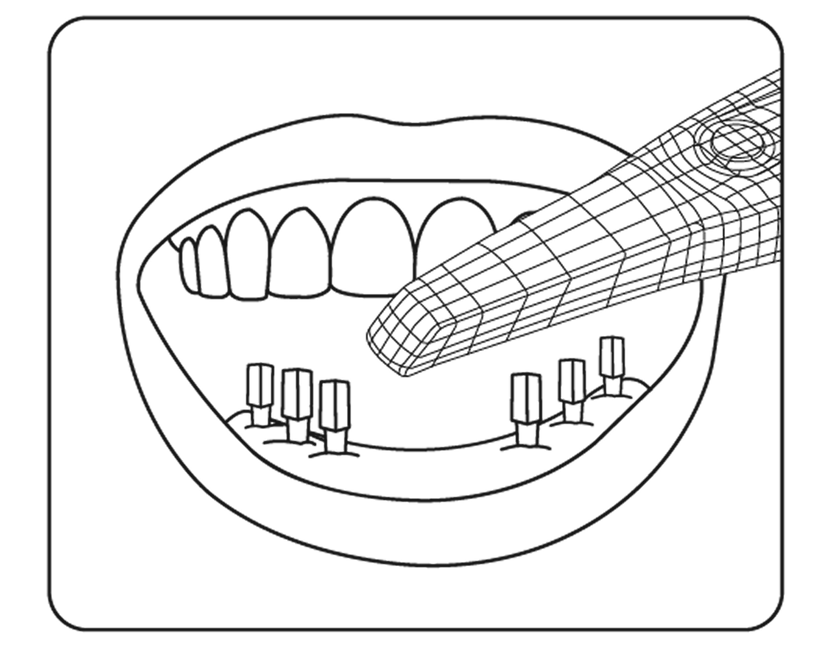 Initial intraoral scan